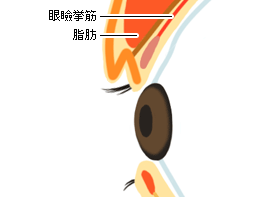 まつげの下にある余分なタルミを切除3