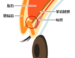 二重まぶたの断面図