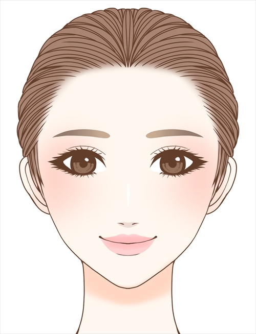 シルエットソフト（3Dリフト）術後