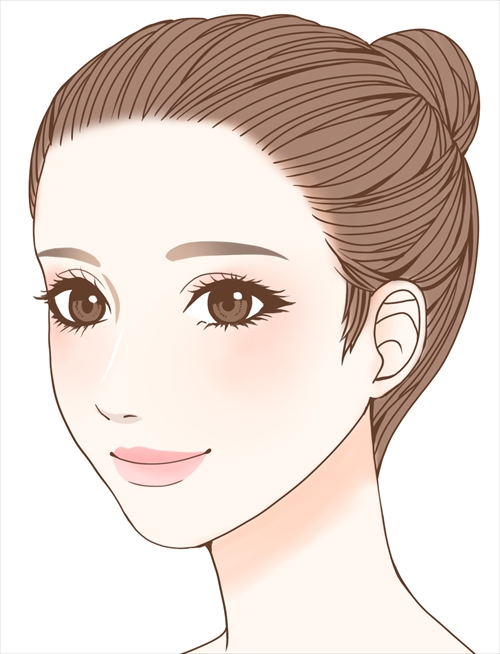 シルエットソフト（3Dリフト）術後